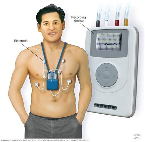 heart test machine|24 hour heart monitor palpitations.